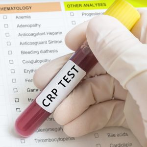 CRP-teszt-antibiotikumok