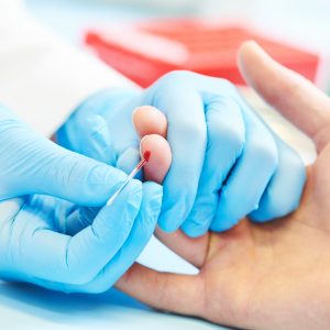 klinikai vérteszt crp-teszt